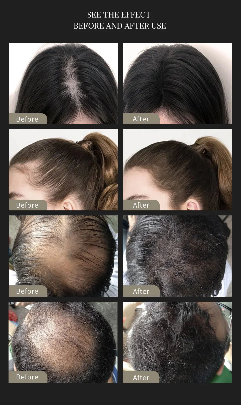 3pcs Hair Fibers Set Keratin Hair Building Styling Powder Hair Loss Instant Regrowth Thickening Powders Hairline Beard Filling